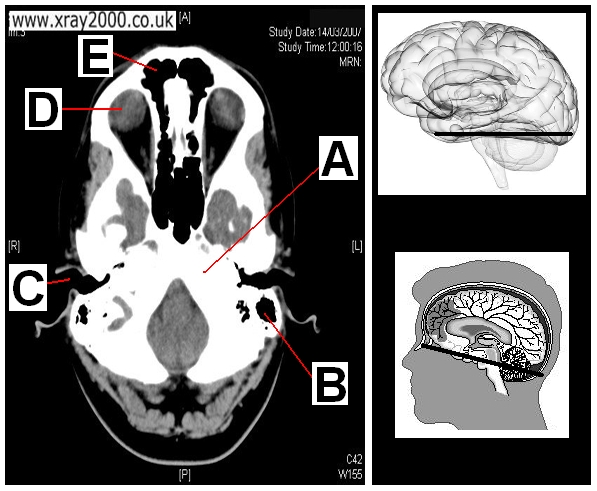 AXIAL SECTION 12.JPG